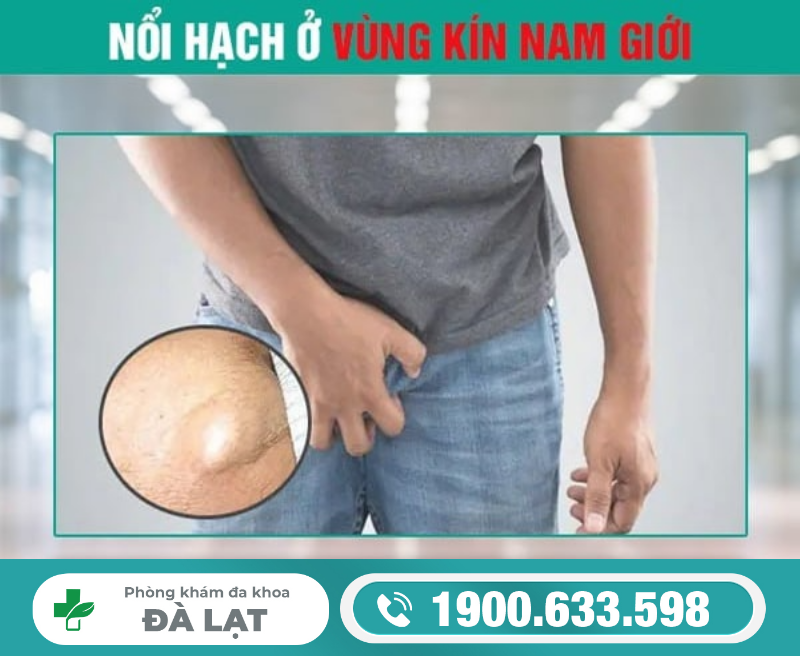 Hình ảnh minh họa